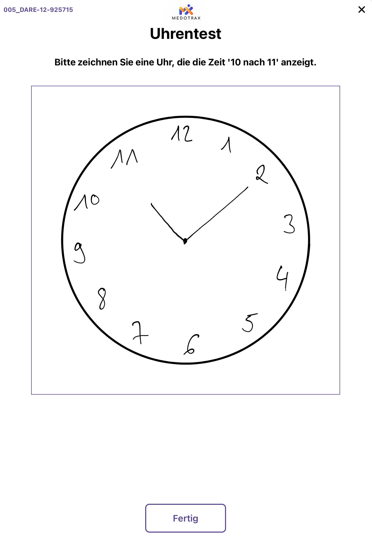 Uhrentest – BraincheX